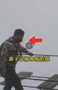 官方辟谣游客玩网红桥被割鼻子：